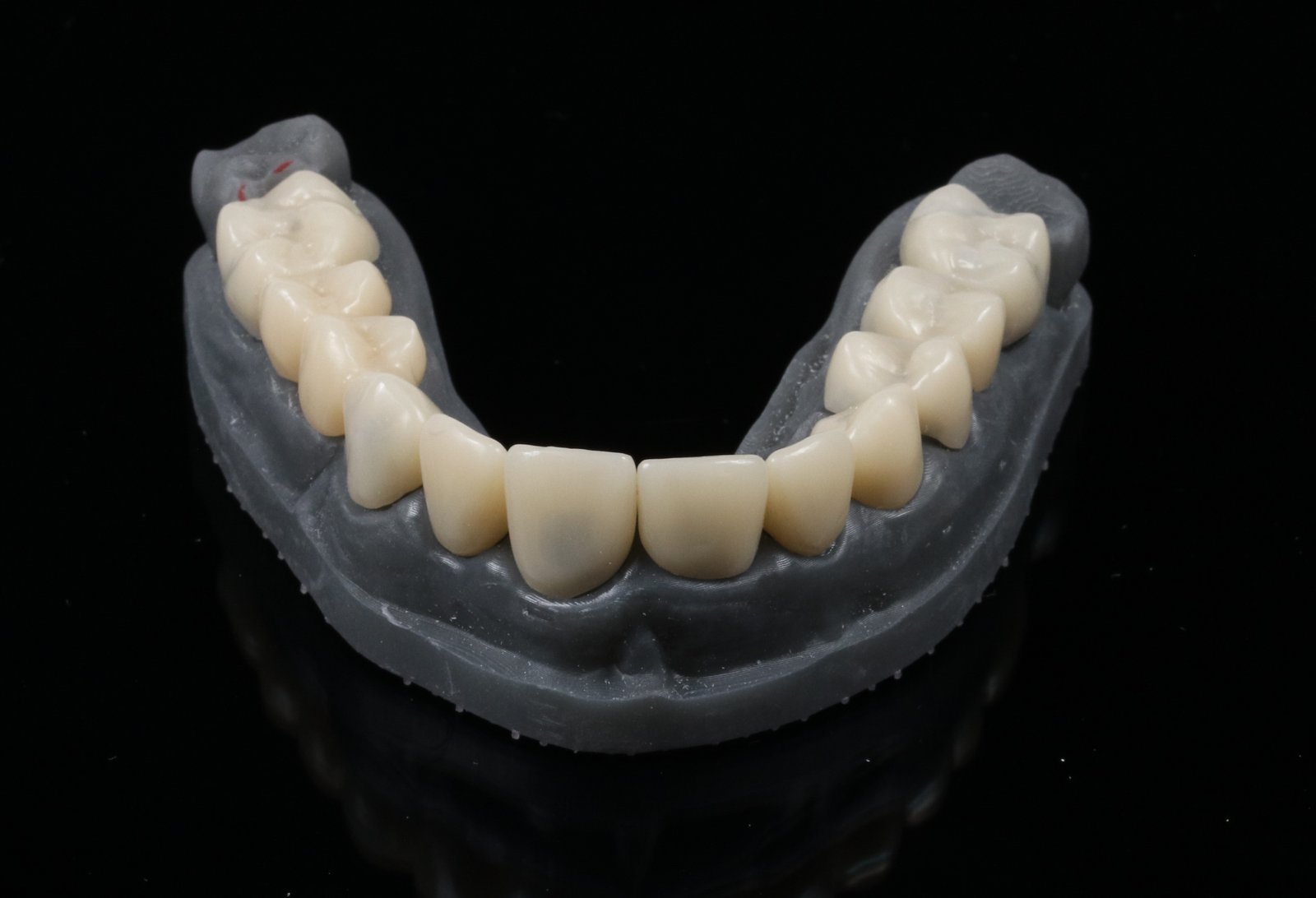 Rehabilitación Adhesiva